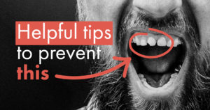 Bearded man with chipped front tooth