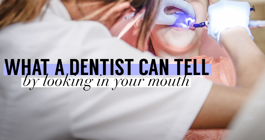 Dentist Examining Patient Mouth